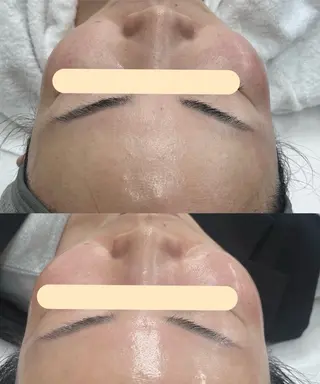 小顔・肌質改善 espoir 心斎橋のエステ・リラクイメージ