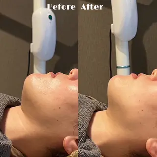 miyu 🩵のエステ・リラクイメージ