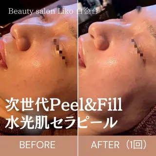 Beauty salon  Liko所属・LIKO フェイシャル&ボディのエステ・リラクイメージ