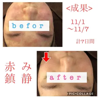 ショート パーマ ヘアアレンジ メンズ キッズ ネイル マツエク・マツパ 顔タイプ診断 ayakaのエステ・リラクイメージ