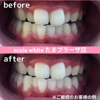 セルフホワイトニング　エクシアたまプラーザ店所属・セルフホワイトニング エクシアたまプラーザのその他イメージ