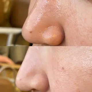 MiEL  total beaty salon所属・肌質改善サロン ナツコのエステ・リラクイメージ