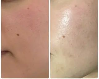 美肌脱毛専門サロン muro.のエステ・リラクイメージ