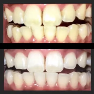 ビューティーホリック 東金店のエステ・リラクイメージ