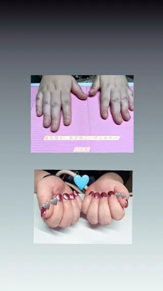 メンズ ネイル 爪ケア/深爪 自爪育成 🐰えむのネイルデザイン