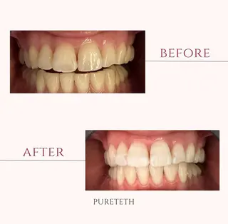 ホワイトニングサロンPURETETH所属・ホワイトニングサロン PURETETHのエステ・リラクイメージ