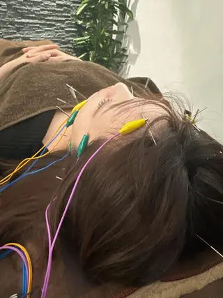 美容鍼灸整体サロンBeauJu所属・小顔矯/美容鍼/鍼灸 BeauJuのその他イメージ