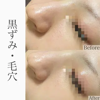 ハーブピーリング専門 BIOEL横浜のエステ・リラクイメージ