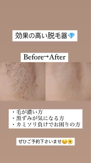 ロング カラー パーマ ヘアアレンジ メンズ キッズ ネイル マツエク・マツパ アイブロウ Chloe-クロエ- 脱毛/フェイシャルのエステ・リラクイメージ