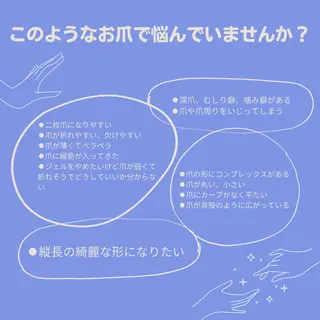 ネイル ステラ marikominoのネイルデザイン