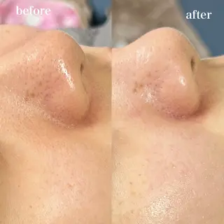 hitomi ヒトミのエステ・リラクイメージ