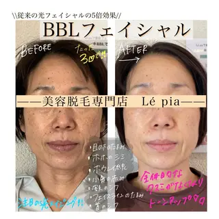 肌質管理専門店 Lé pia　AMIのエステ・リラクイメージ