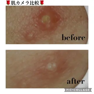 触れたくなる モテ肌へ...❤︎のエステ・リラクイメージ