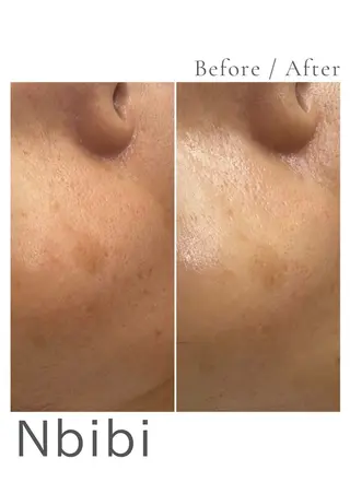 韓国🇰🇷価格 サロン_Nbibiのエステ・リラクイメージ