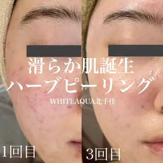 WHITE AQUA 北千住店のエステ・リラクイメージ