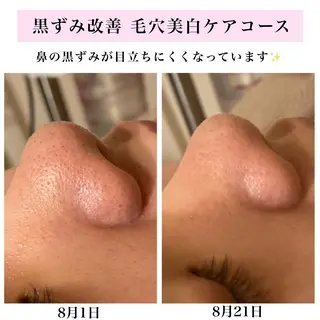 Bellesthe (ベルエステ)のエステ・リラクイメージ