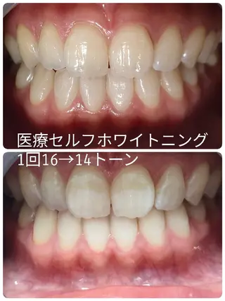 ホワイトアザブ WhiteAzabuのマツエク・マツパデザイン