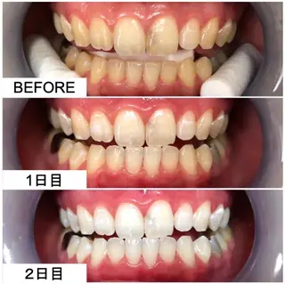 セルフホワイトニングサロンMW 稲毛店所属・セルフホワイトニング サロンMW稲毛店のその他イメージ