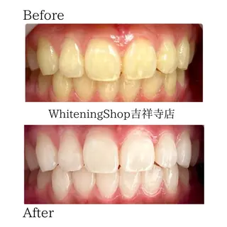 ホワイトニング ショップ吉祥寺店のエステ・リラクイメージ