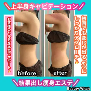 痩身/脱毛/ネイル HARUKAのエステ・リラクイメージ