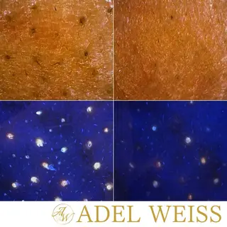 毛穴ケア＆脱毛サロン　ADEL WEISS所属・毛穴ケア＆脱毛サロン ADEL　WEISSのエステ・リラクイメージ