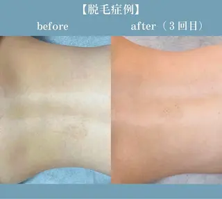 【京都市最安値】 salon YMのエステ・リラクイメージ