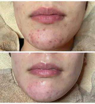 代表 MOMOの眉毛・アイブロウイメージ