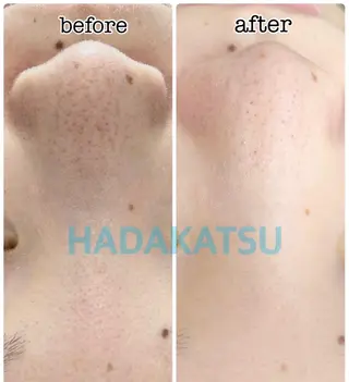 総合エステサロン 肌活のエステ・リラクイメージ