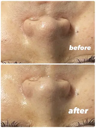 blue.【都度払い脱毛&フェイシャルサロン】所属・blue.💙【 脱毛&フェイシャル】のエステ・リラクイメージ