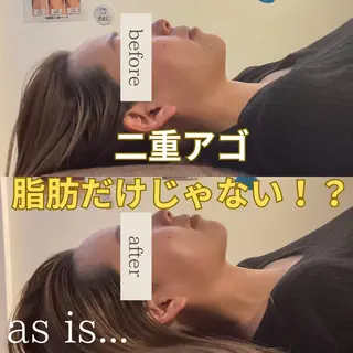 小顔専門アズイズ ビューティー　草津店のエステ・リラクイメージ