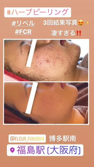 FLEUR大阪・整体 ・ハイフ・痩身・小顔のエステ・リラクイメージ