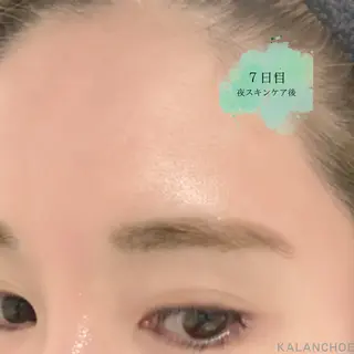 肌質改善 KALANCHOEのエステ・リラクイメージ