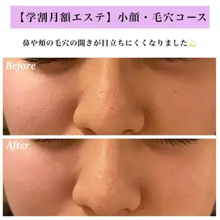 Bellesthe (ベルエステ)のエステ・リラクイメージ