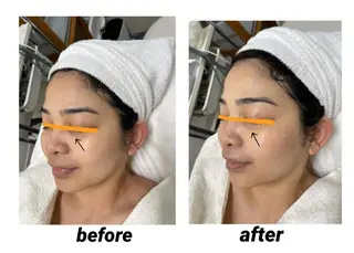 DeI'm   名古屋栄所属・小林 玲菜のエステ・リラクイメージ