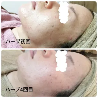 未病ケアサロン EMINY所属・未病ケアサロン EMINY☺︎勝俣のエステ・リラクイメージ