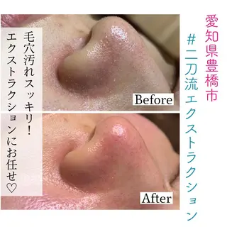 Organic&Detox salon Beloved所属・Beloved えなかのエステ・リラクイメージ