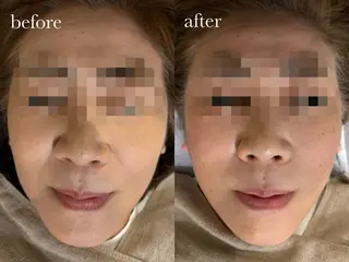 ENNE🦩小顔整体 師🌿 HINAKOのエステ・リラクイメージ