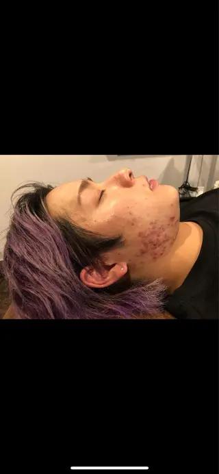 美容鍼灸サロン LOMIHARIのエステ・リラクイメージ