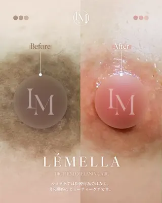 NAIL＆EYELASH SALON Lovers MOMO ～ラヴァーズ モモ～所属・Lovers MOMOのエステ・リラクイメージ