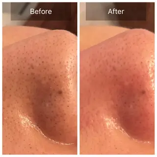 Lumiere despoir所属・Lumiere despoirのエステ・リラクイメージ