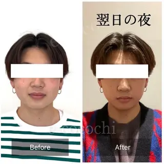 小顔と ヘッドスパのお店のエステ・リラクイメージ