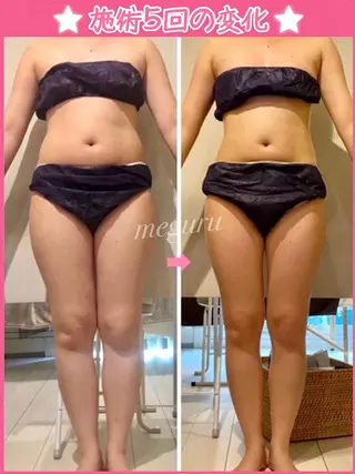 ショート カラー パーマ ヘアアレンジ メンズ キッズ ネイル マツエク・マツパ 痩身&ボディ 結果出し🌟丹野のエステ・リラクイメージ