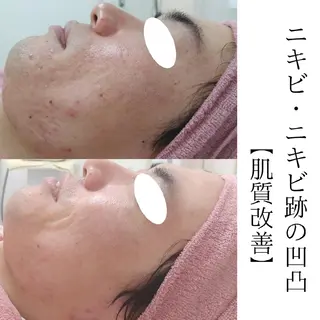 ユニセックスエステサロンUniclear所属・男女エステ ユニクリアのエステ・リラクイメージ