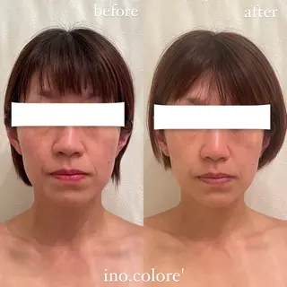 エステサロンino.colore'所属・小顔サロン ino.coloreのエステ・リラクイメージ