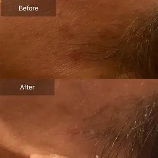 Mandarin Orange所属・毛穴から始める肌メン テマンダリンオレンジのエステ・リラクイメージ