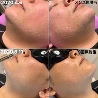 メンズ 脱毛＆エステサロン【アンリミット】所属・森谷 莉美のエステ・リラクイメージ