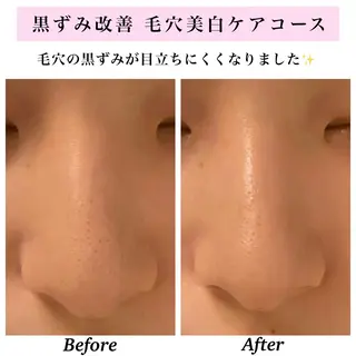 Bellesthe (ベルエステ)のエステ・リラクイメージ