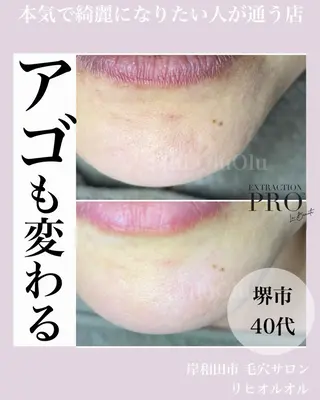 毛穴汚れ改善専門店/ 岸和田/リヒオルオルのエステ・リラクイメージ