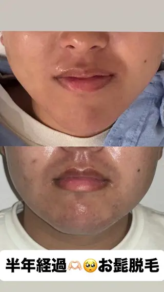 beauty salon LUCIALL所属・HBL【眉毛】・脱毛 LUCIALLの眉毛・アイブロウイメージ