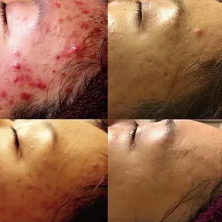 Charme Esbeaute所属・南森町 ｃｅのマツエク・マツパデザイン